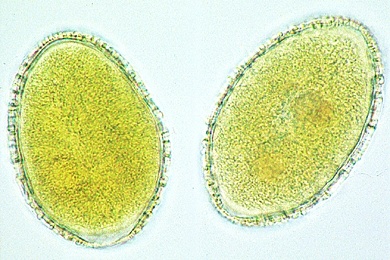 Mikropräparat - Lilie, Reife Pollenkörner, total. Oberflächenstruktur