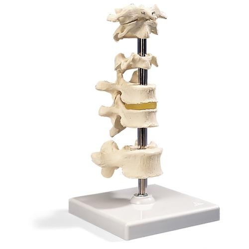 6 Wirbel, auf Stativ