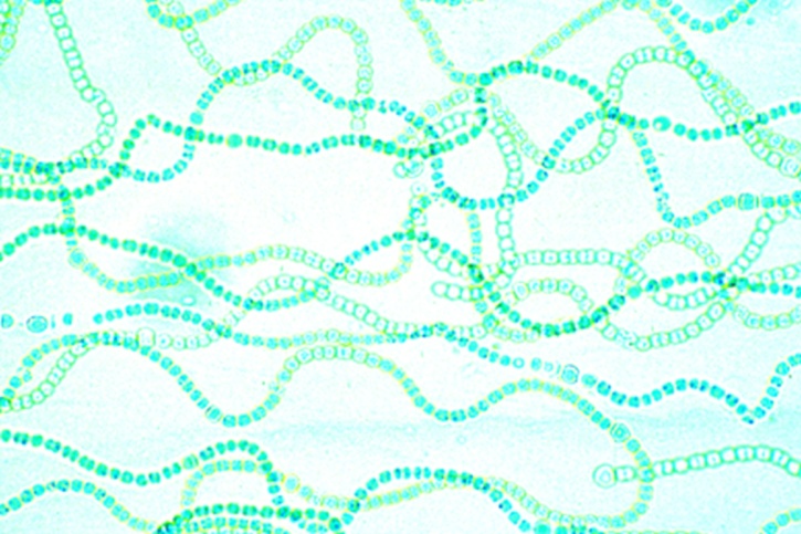 Mikropräparat - Nostoc, fadenförmige Kolonien mit Heterocysten und Gallerthülle, total