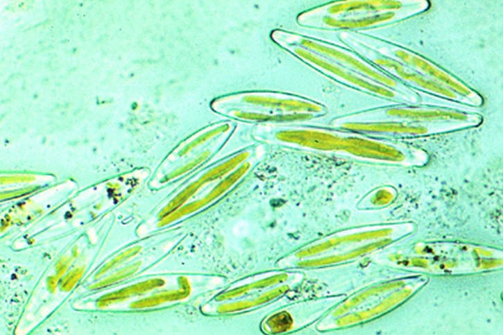Mikropräparat - Süßwasserdiatomeen , Färbung der Chromatophoren