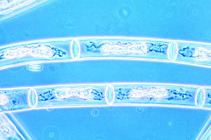 Mikropräparat - Mougeotia, plattenförmige Chloroplasten
