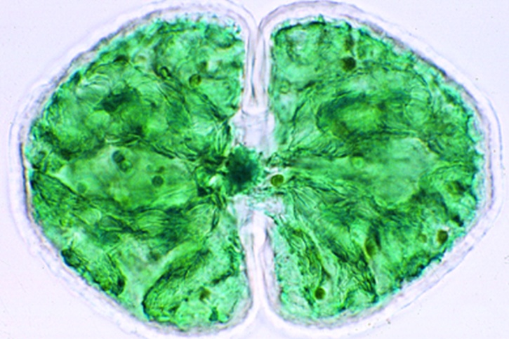 Mikropräparat - Cosmarium, Zieralge