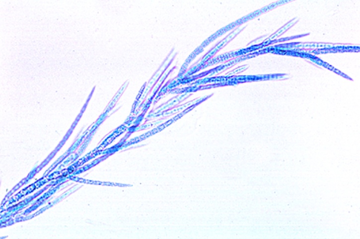 Mikropräparat - Chaetophora, stark verzweigter Thallus