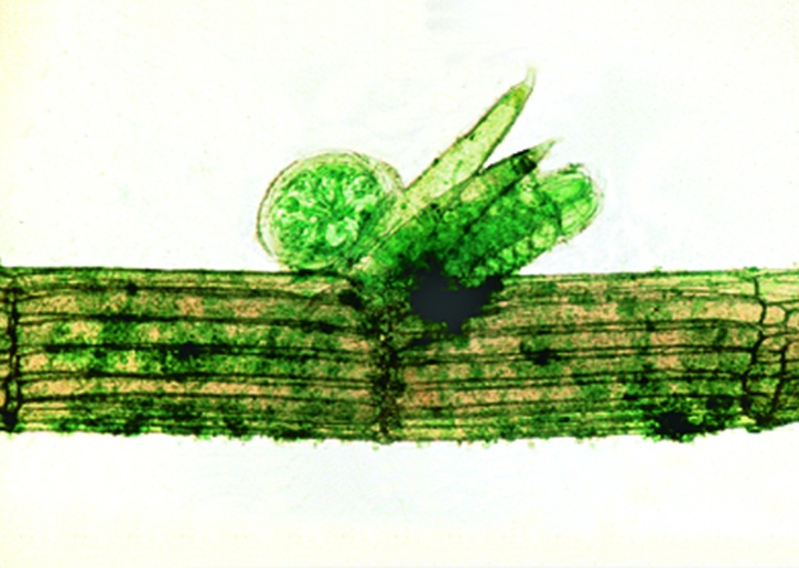 Mikropräparat - Chara, Armleuchteralge, mit Geschlechtsorganen