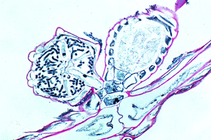 Mikropräparat - Chara, Thallus und Geschlechtsorgane, längs