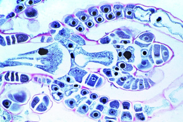Mikropräparat - Chara, Scheitel längs *