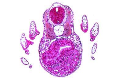 Mikropräparat - Salamander-Larve, Region der äußeren Kiemen, quer