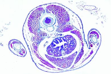 Mikropräparat - Salamander-Larve, Brustregion und Vorderbeine, quer