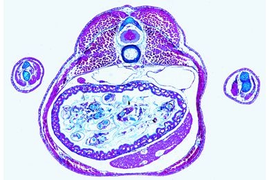 Mikropräparat - Salamander-Larve, Abdominalregion, quer