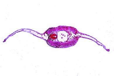 Mikropräparat - Salamander-Larve, Schwanz quer