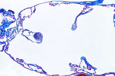 Mikropräparat - Salamandra, Lunge quer