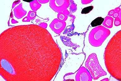 Mikropräparat - Rana, Eierstock quer, Reifende Follikel, Dotter