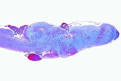 Mikropräparat - Rana, Gehirn sagittal längs