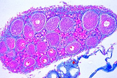 Mikropräparat - Lumbricus, Ovarium quer *