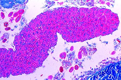 Mikropräparat - Lumbricus, Hoden quer *