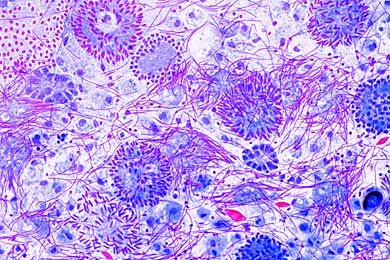 Mikropräparat - Lumbricus, Spermatozoen, Ausstrich Mikropräparat - Lumbricus, Spermatozoen, Ausstrich