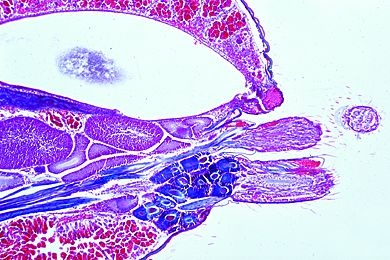 Mikropräparat - Spinne, Abdomen längs, mit Spinndrüsen und Spinnwarzen