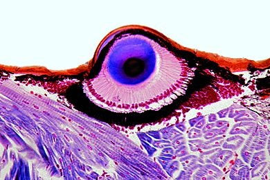 Mikropräparat - Salticus, Springspinne, Cephalothorax mit Teleskopaugen *