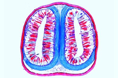 Mikropräparat - Scorpion, Schnitt mit Giftdrüsen