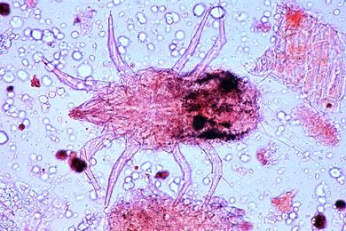 Mikropräparat - Tyroglyphus farinae, Mehlmilben