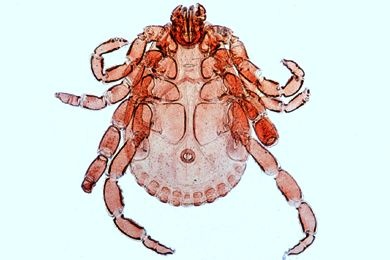 Mikropräparat - Dermacentor andersoni, Zecke, total (Überträger des Fleckfiebers)