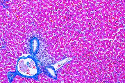 Mikropräparat - Gallus, Leber quer