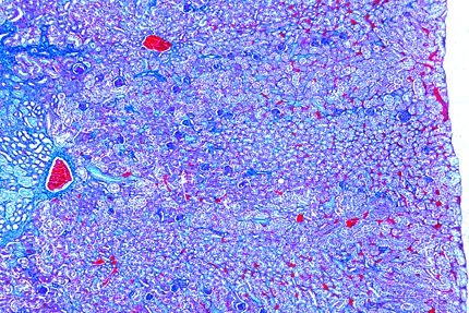 Mikropräparat - Gallus, Niere quer