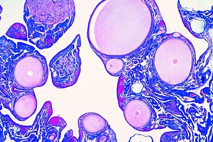 Mikropräparat - Gallus, Eierstock quer, Eientwicklung