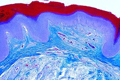 Mikropräparat - Gallus, Haut der Fußsohle quer
