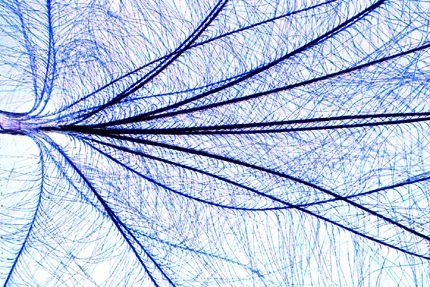 Mikropräparat - Flaumfeder vom Vogel, total