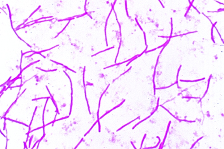 Mikropräparat - Bacillus mesentericus. Ausstrich von Kultur