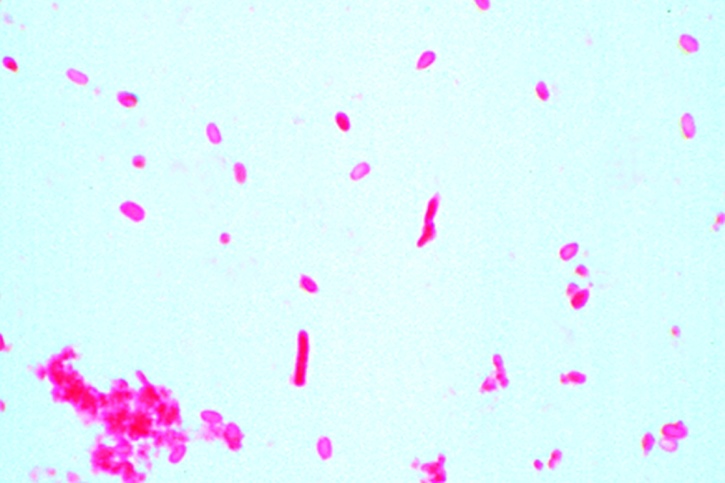 Mikropräparat - Bacillus anthracis. Sporenfärbung, Ovale