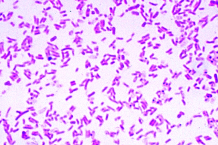 Mikropräparat - Aerobacter aerogenes. Ausstrich von Kultur