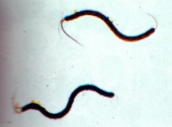Mikropräparat - Spirillum volutans. sehr große Organismen *