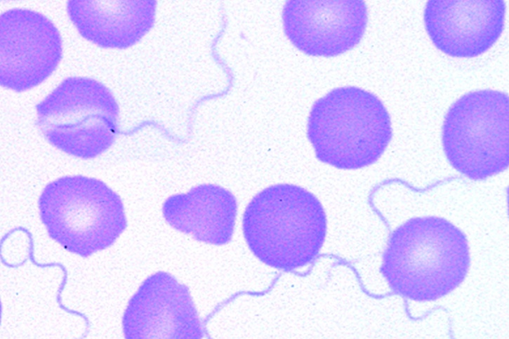 Mikropräparat - Spirochaeta duttoni (recurrentis). Erreger des Rückfallfiebers.