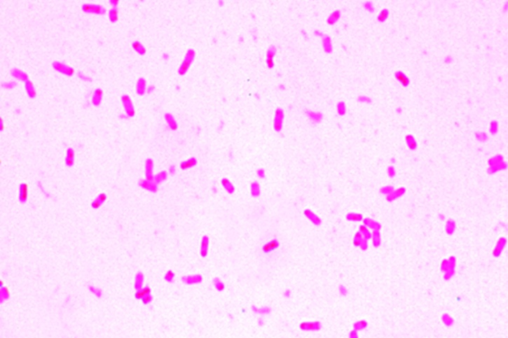 Mikropräparat - Typische Bazillen (stäbchenförmig). Gramnegativ. Ausstrich