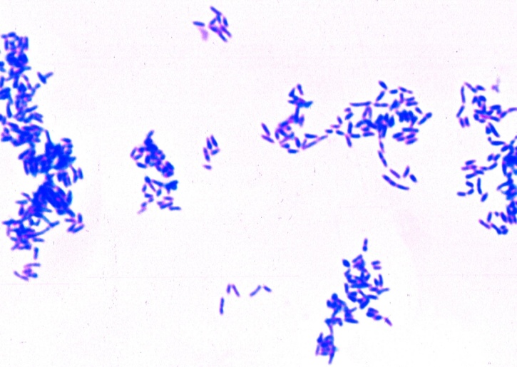 Mikropräparat - Typische Bazillen (stäbchenförmig). Grampositiv. Ausstrich