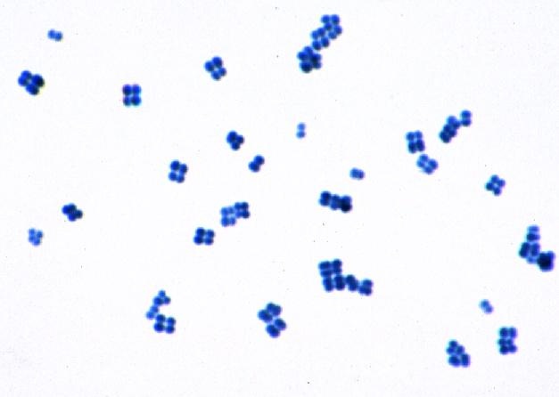 Mikropräparat - Typische Kokken (rund). Grampositiv. Ausstrich