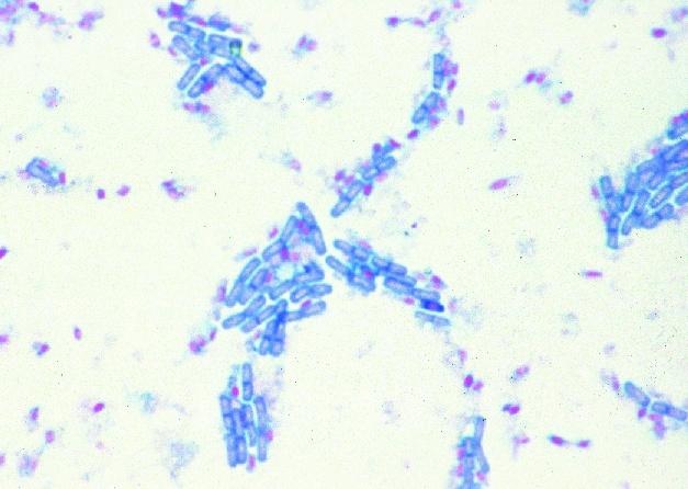 Mikropräparat - Typische Bazillen in Ketten (Streptobazillen). Ausstrich