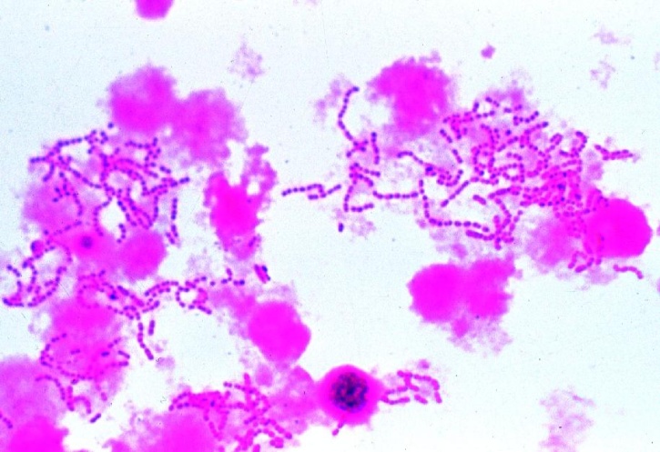 Mikropräparat - Typische Kokken in Ketten (Streptokokken). Ausstrich