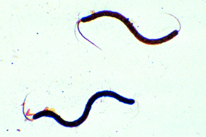 Mikropräparat - Geißelfärbung. lophotriche Begeißelung. Spirillum *