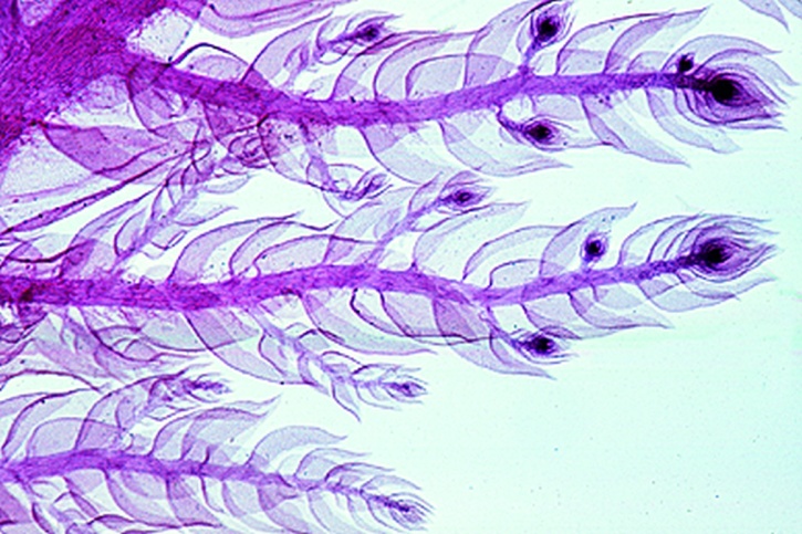 Mikropräparat - Mnium, junger Gametophyt mit beblättertem Sproß *