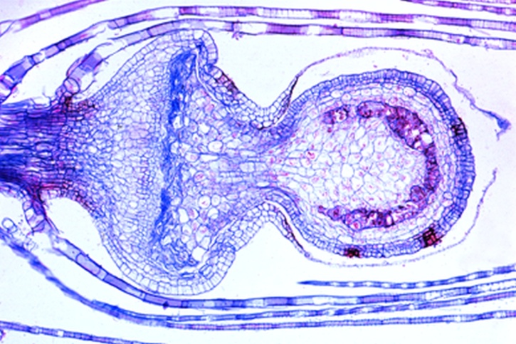 Mikropräparat - Sphagnum, junges Sporogon, längs