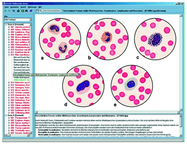 Vererbung und Genetik des Menschen Teil II, Interaktive CD-ROM