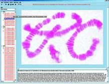 Anatomie der Blütenlosen Pflanzen (Kryptogamen), Interaktive CD-ROM