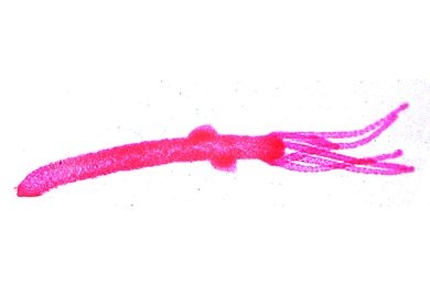 Mikropräparat - Hydra, Totalpräparat mit Hoden Mikropräparat - Hydra, Totalpräparat mit Hoden