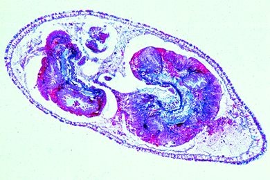Mikropräparat - Hydra mit Nahrung, Querschnitt Mikropräparat - Hydra mit Nahrung, Querschnitt