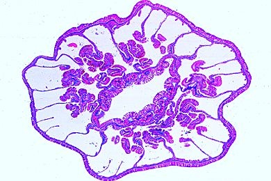 Mikropräparat - Actinia equina, Seerose, Querschnitt
