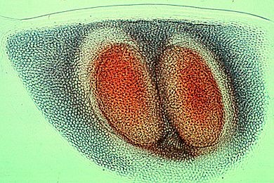 Mikropräparat - Daphnia, Ephippien