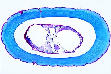 Mikropräparat - Astacus, Antenne quer (entkalkt) Mikropräparat - Astacus, Antenne quer (entkalkt)